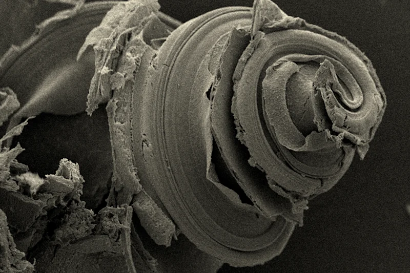 Article 3 Hair cells in the inner ear