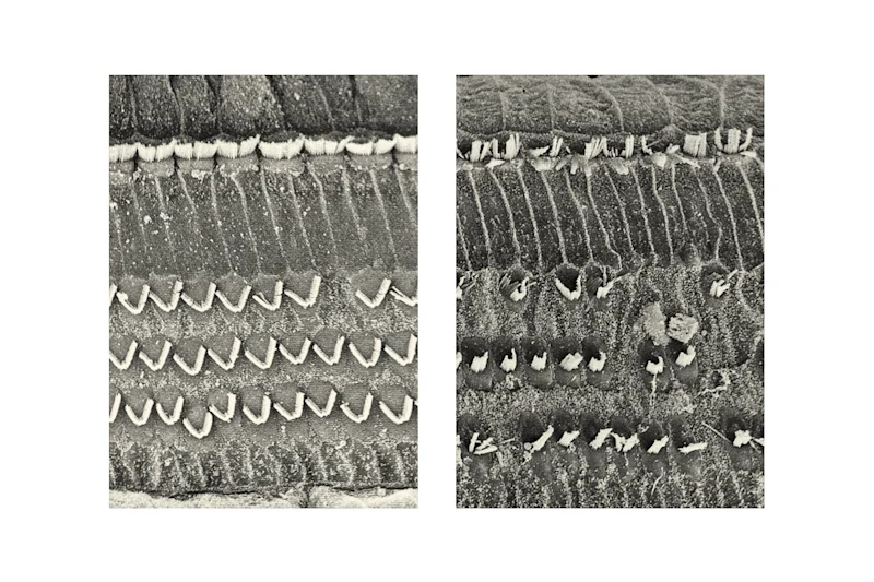 Article 5 Hair cells in the inner ear